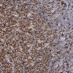 PIWIL4 Polyclonal Antibody