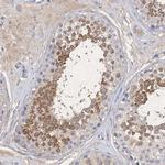 C11orf58 Polyclonal Antibody