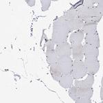 DDX21 Antibody in Immunohistochemistry (IHC)