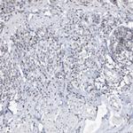 DDX21 Antibody in Immunohistochemistry (IHC)