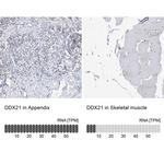 DDX21 Antibody