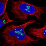 DDX21 Polyclonal Antibody