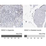 DDX21 Antibody in Immunohistochemistry (IHC)