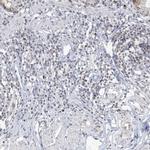 DDX21 Antibody in Immunohistochemistry (IHC)