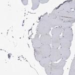 DDX21 Antibody in Immunohistochemistry (IHC)