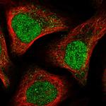 APC15 Polyclonal Antibody