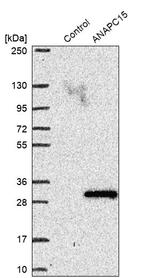 APC15 Antibody in Western Blot (WB)