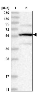 PPP2R5B Antibody in Western Blot (WB)