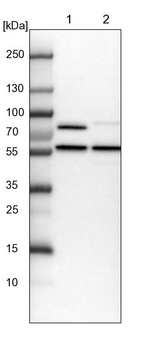 PPP2R5B Antibody in Western Blot (WB)