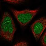 FAM76B Polyclonal Antibody