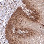 OTUD4 Antibody in Immunohistochemistry (Paraffin) (IHC (P))