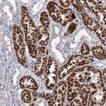 CHDH Polyclonal Antibody