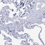 CHDH Antibody in Immunohistochemistry (IHC)