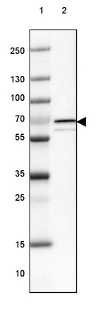 CHDH Antibody in Western Blot (WB)