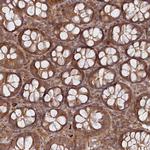 ABHEB Antibody in Immunohistochemistry (Paraffin) (IHC (P))