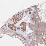 ABHEB Antibody in Immunohistochemistry (Paraffin) (IHC (P))