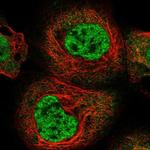 RBM15B Polyclonal Antibody