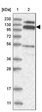 RBM15B Antibody in Western Blot (WB)