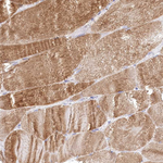 STT3B Antibody in Immunohistochemistry (Paraffin) (IHC (P))