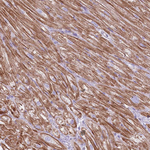 STT3B Antibody in Immunohistochemistry (Paraffin) (IHC (P))