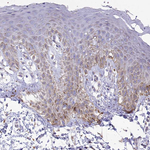 STT3B Antibody in Immunohistochemistry (Paraffin) (IHC (P))