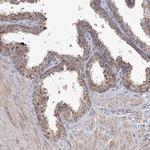 GRPEL1 Antibody in Immunohistochemistry (Paraffin) (IHC (P))