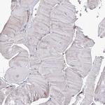 GRPEL1 Antibody in Immunohistochemistry (Paraffin) (IHC (P))