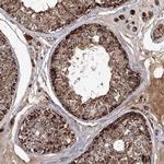 GRPEL1 Antibody in Immunohistochemistry (Paraffin) (IHC (P))