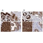 UGDH Antibody in Immunohistochemistry (IHC)