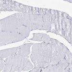 UGDH Antibody in Immunohistochemistry (IHC)