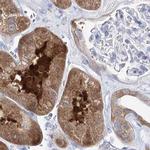 UGDH Antibody in Immunohistochemistry (IHC)