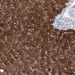 UGDH Antibody in Immunohistochemistry (IHC)