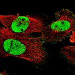 PDS5A Polyclonal Antibody