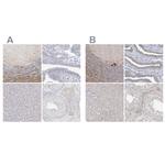 LRP2BP Polyclonal Antibody