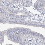 LRP2BP Antibody in Immunohistochemistry (IHC)