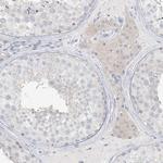 LRP2BP Antibody in Immunohistochemistry (IHC)