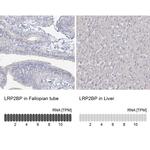 LRP2BP Antibody