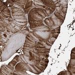 KY Polyclonal Antibody