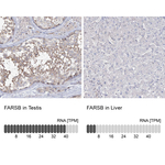 FARSB Antibody in Immunohistochemistry (Paraffin) (IHC (P))