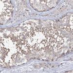 FARSB Antibody in Immunohistochemistry (Paraffin) (IHC (P))