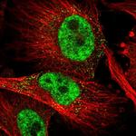 SLC4A1AP Polyclonal Antibody