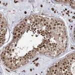 SLC4A1AP Antibody in Immunohistochemistry (Paraffin) (IHC (P))