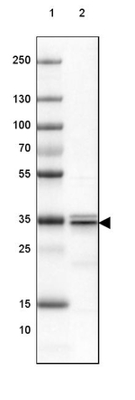 SUCLG1 Antibody in Western Blot (WB)