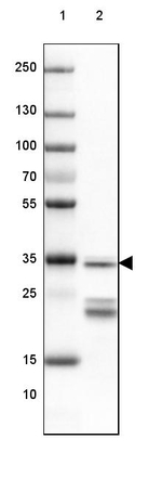 SUCLG1 Antibody in Western Blot (WB)