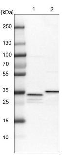 SUCLG1 Antibody in Western Blot (WB)