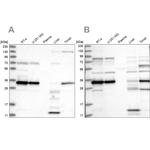SUCLG1 Antibody in Western Blot (WB)