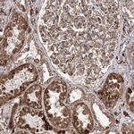 FANCL Polyclonal Antibody