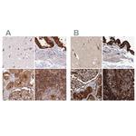 EML4 Polyclonal Antibody