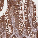 EML4 Antibody in Immunohistochemistry (IHC)