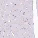EML4 Antibody in Immunohistochemistry (IHC)